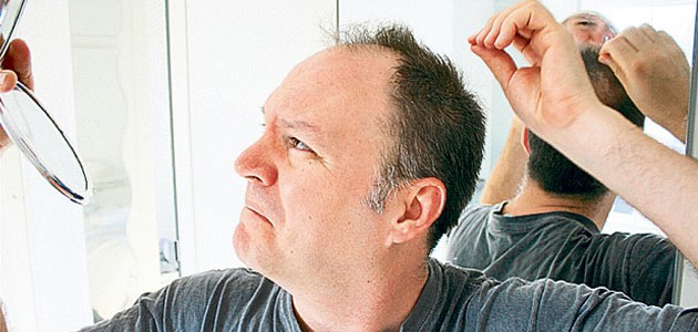A Hair Loss Cure For Men Hair Loss Solutions